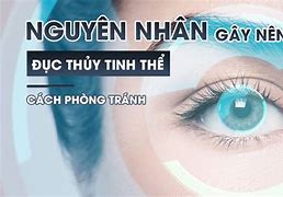 Đục Tinh Thể Là Gì