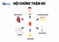 Hội Chứng Thận Hư Ở Trẻ Em Nên Ăn Gì